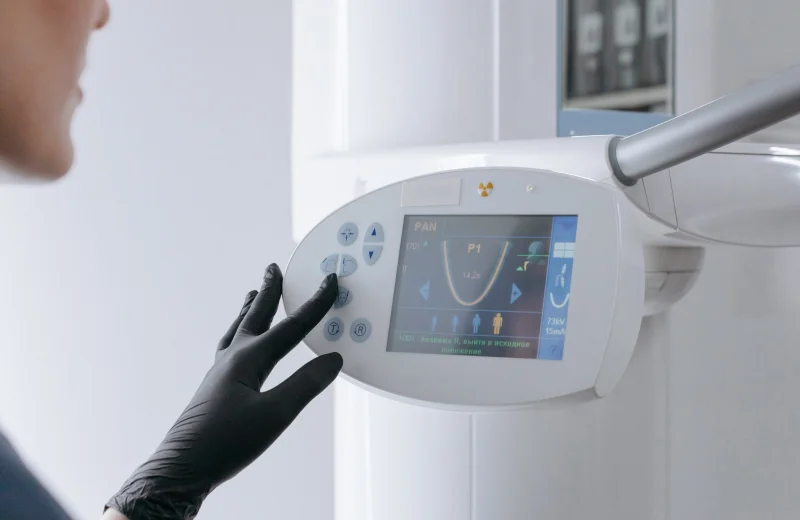 Close-up of a gloved hand interacting with a medical imaging device screen.