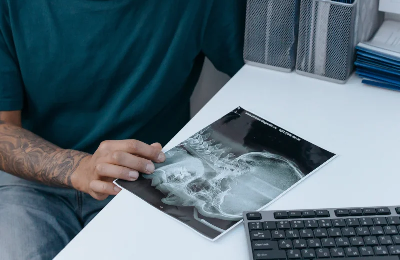 Person examining a dental X-ray image at a desk.