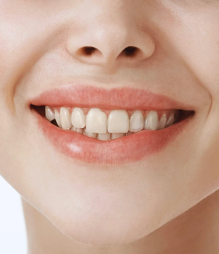 Close-up of a smiling mouth showing teeth.