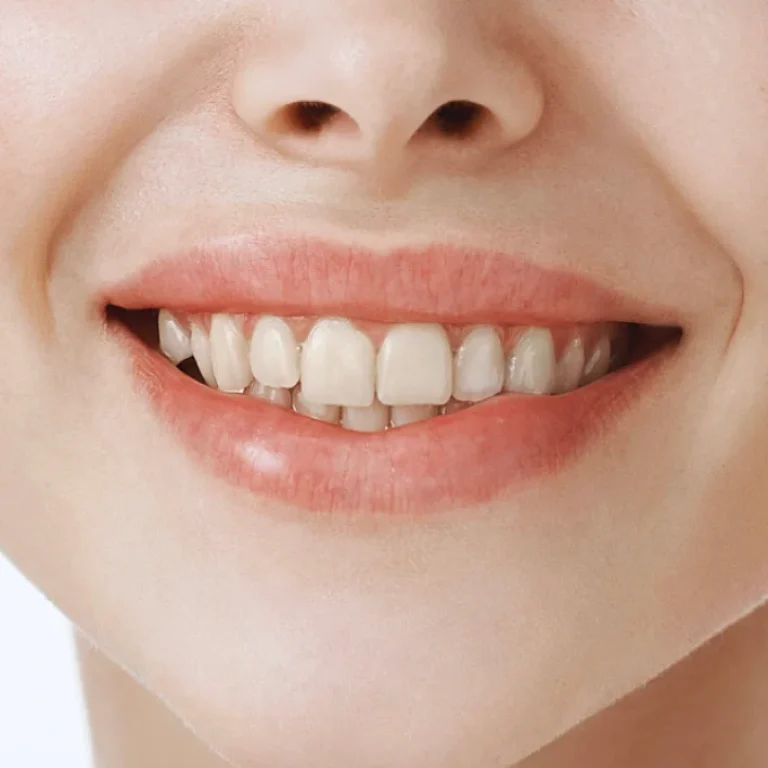 Close-up of a smiling mouth showing teeth.