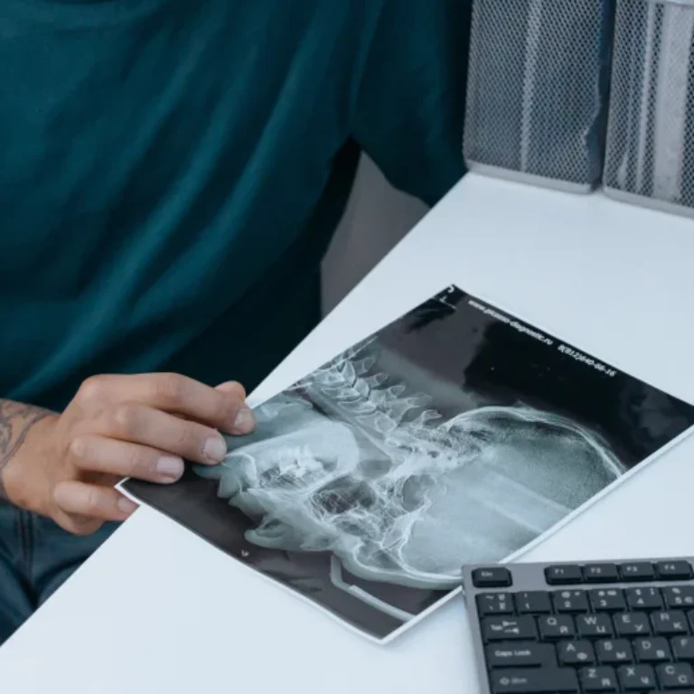 Person examining a dental X-ray image at a desk.